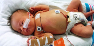 क्या है जानलेवा चमकी बुखार जानिए ? | fact about chamki bukhar fact-about-chamki-bukhar